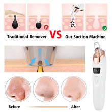 Load image into Gallery viewer, Blackhead Remover Vacuum Acne Pimple Black Spot Suction Electric Facial Pore Cleaner Skincare Exfoliating Beauty Instrument
