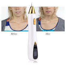 Load image into Gallery viewer, Skin Care Laser Mole Tattoo Freckle Removal Pen LCD Sweep Spot Mole Removing Wart Corns Dark Spot Remover Salon Beauty Machine
